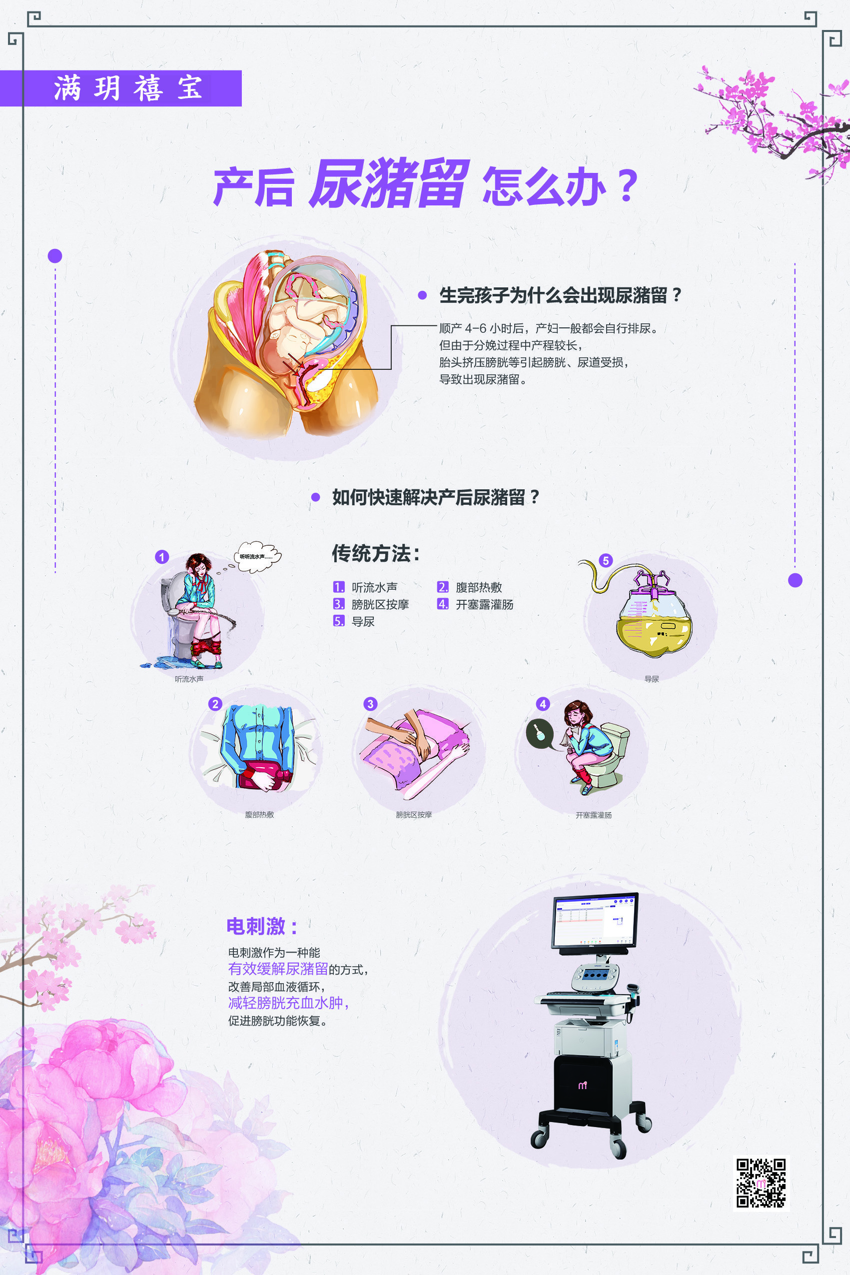 產后尿潴留